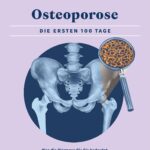 Apotheken Umschau: Osteoporose: Die ersten 100 Tage